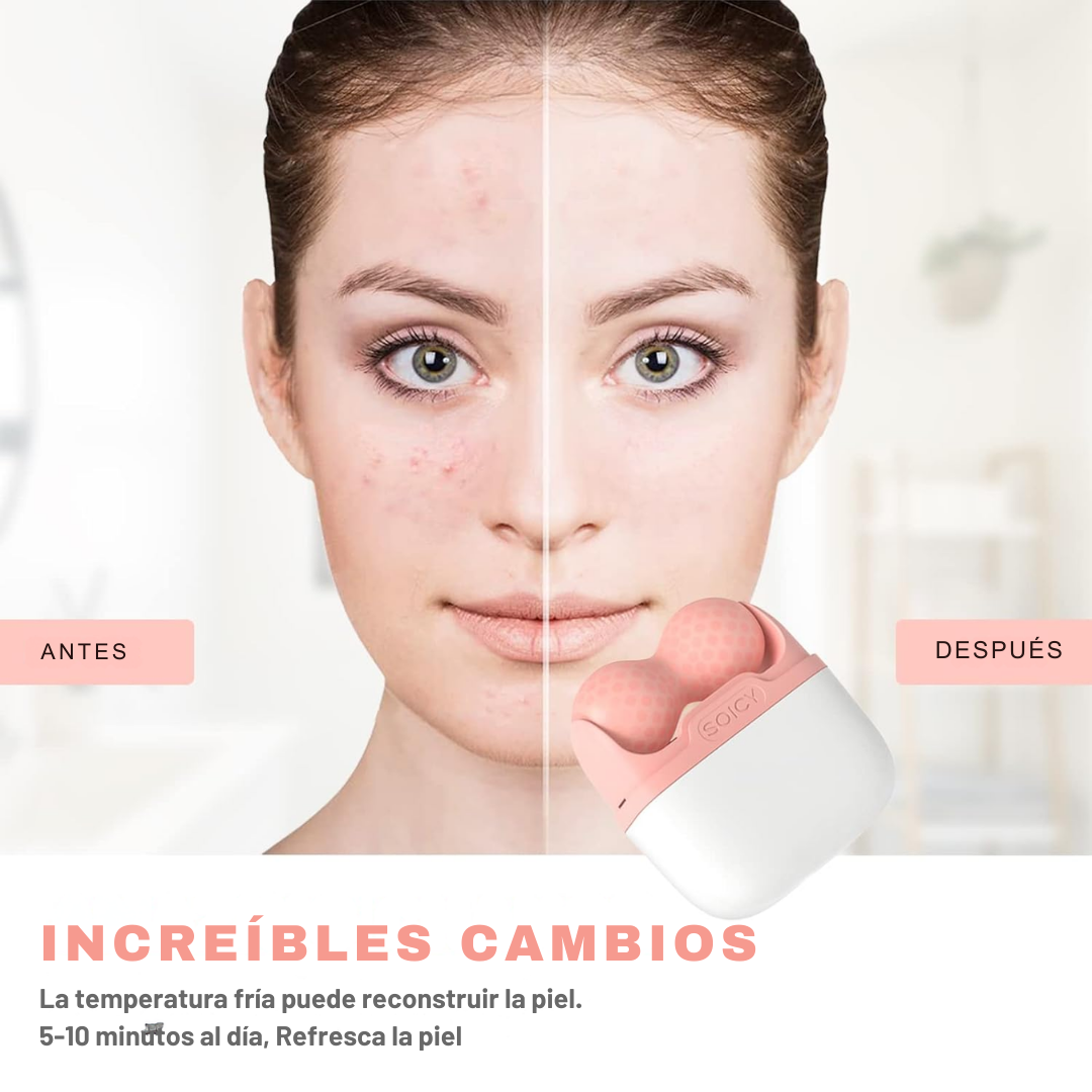 ICE ROLLER - TERAPIA DE HIELO
